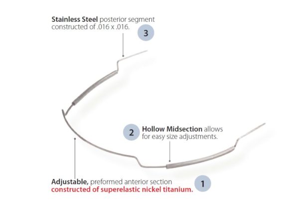 Adjustable Utility Archwires Niti Stainless